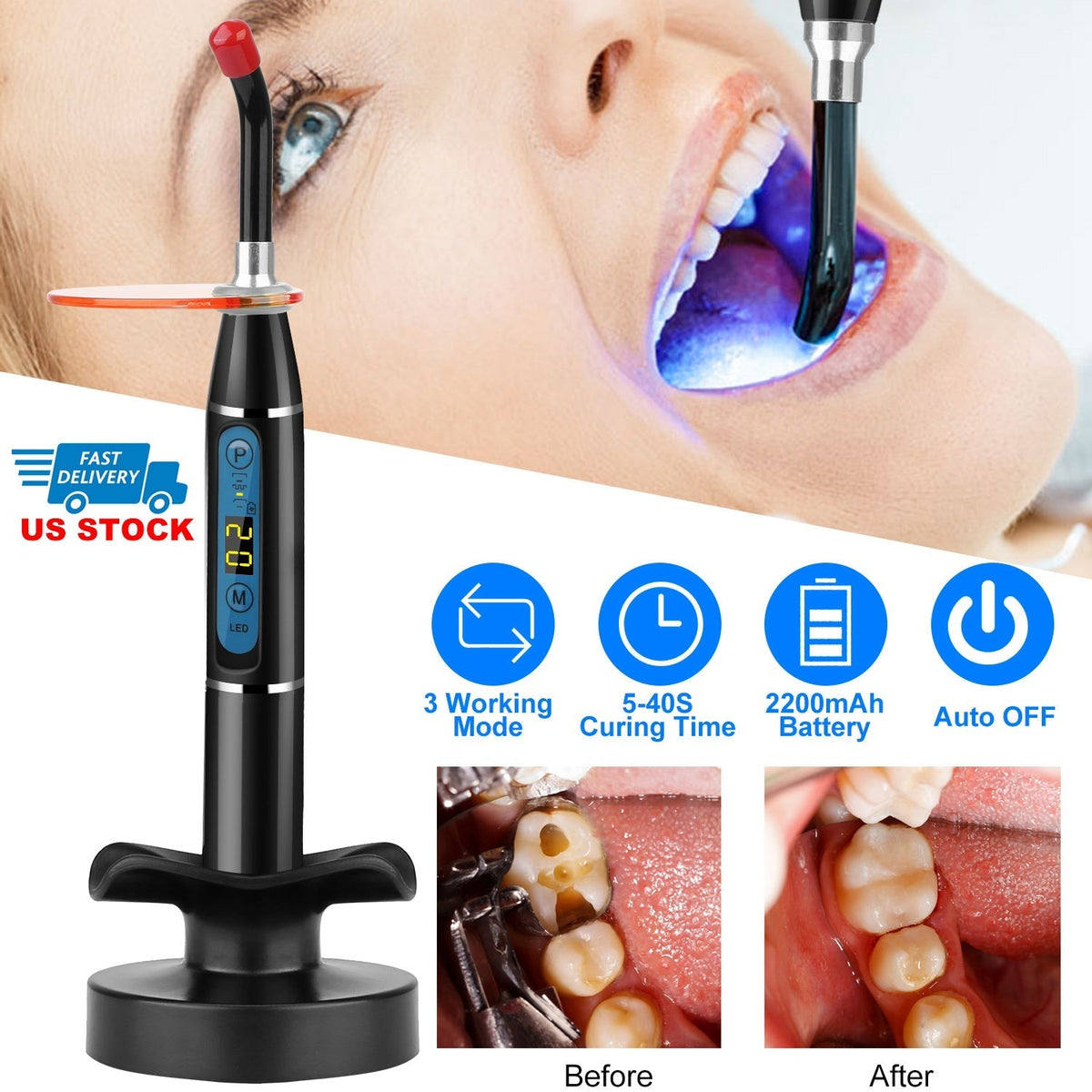 5W Cordless Dental LED Curing Light Lamp 1500mw/cm2